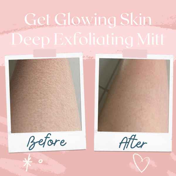 Deep Exfoliating Glove (Gently Peels Away Dead Skin)